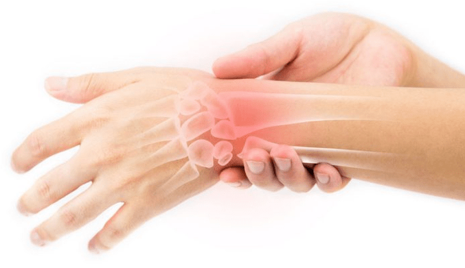 Maladies des articulations, du cartilage et des ligaments Indications pour l'utilisation de Hondrocream