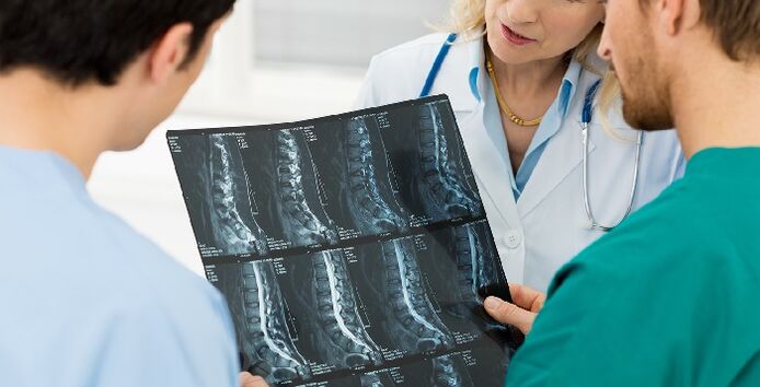 La radiographie de la colonne vertébrale comme moyen de diagnostiquer l'ostéochondrose. 