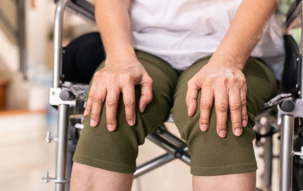 Un patient souffrant d'arthrose des articulations du genou. 